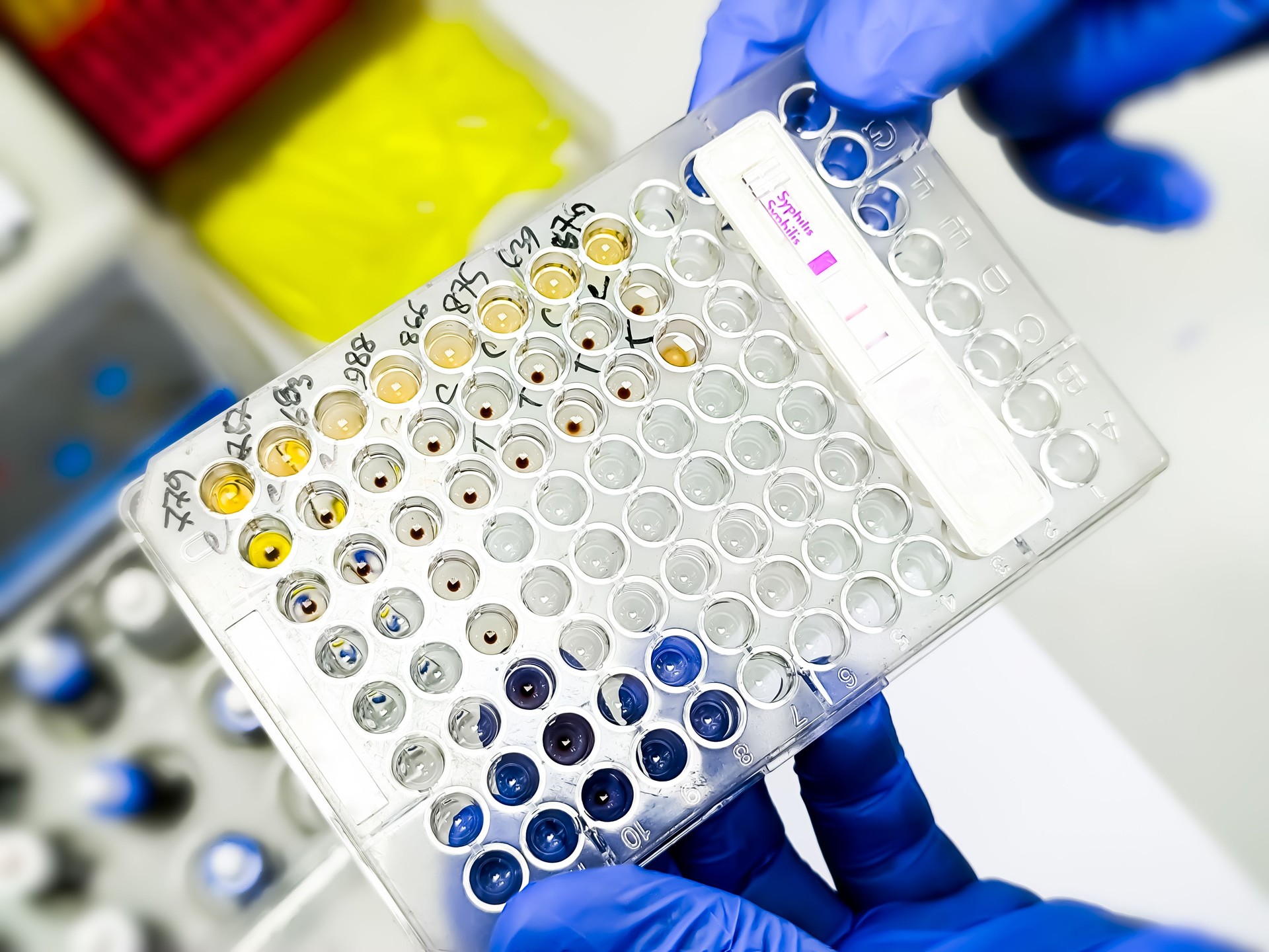 Hemagglutination assay for T. pallidum antibodies. TPHA. ELISA plate and Rapid test cassette, serology testing method in medical laboratory